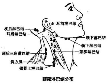 自我检查颈部淋巴结肿大的方法